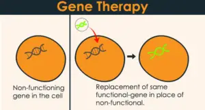 What is Gene Therapy 