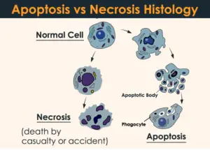 Apoptosis vs Necro Histology